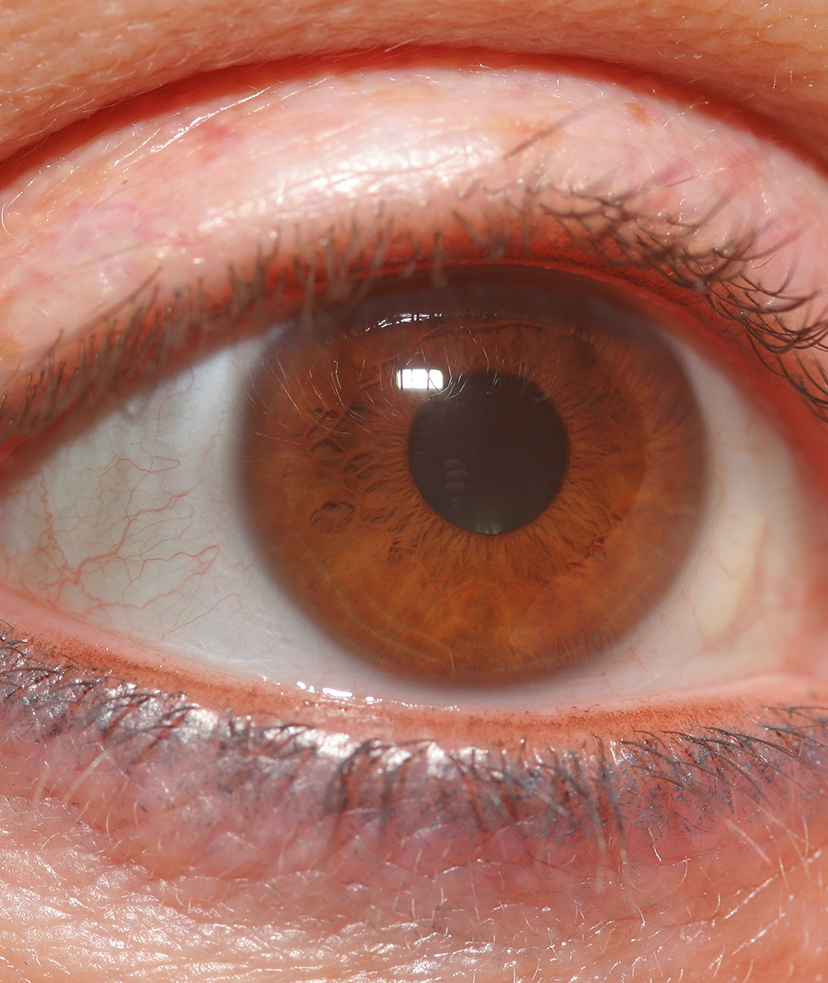Photo of a person's brown eye