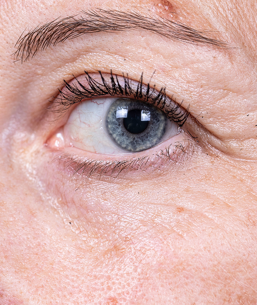 Photo of a person's blue eye and facial wrinkles