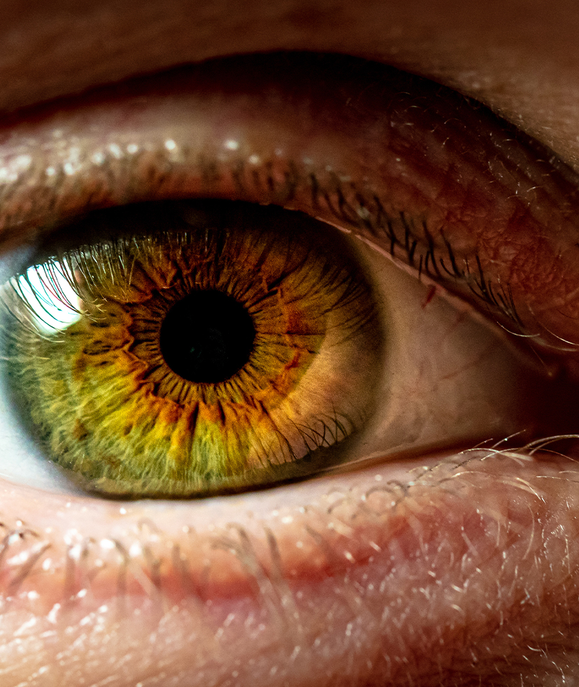 Photo of a person's greenish brown eye