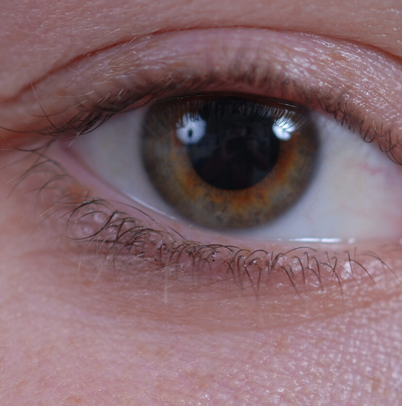 Photo of a person's brown eye