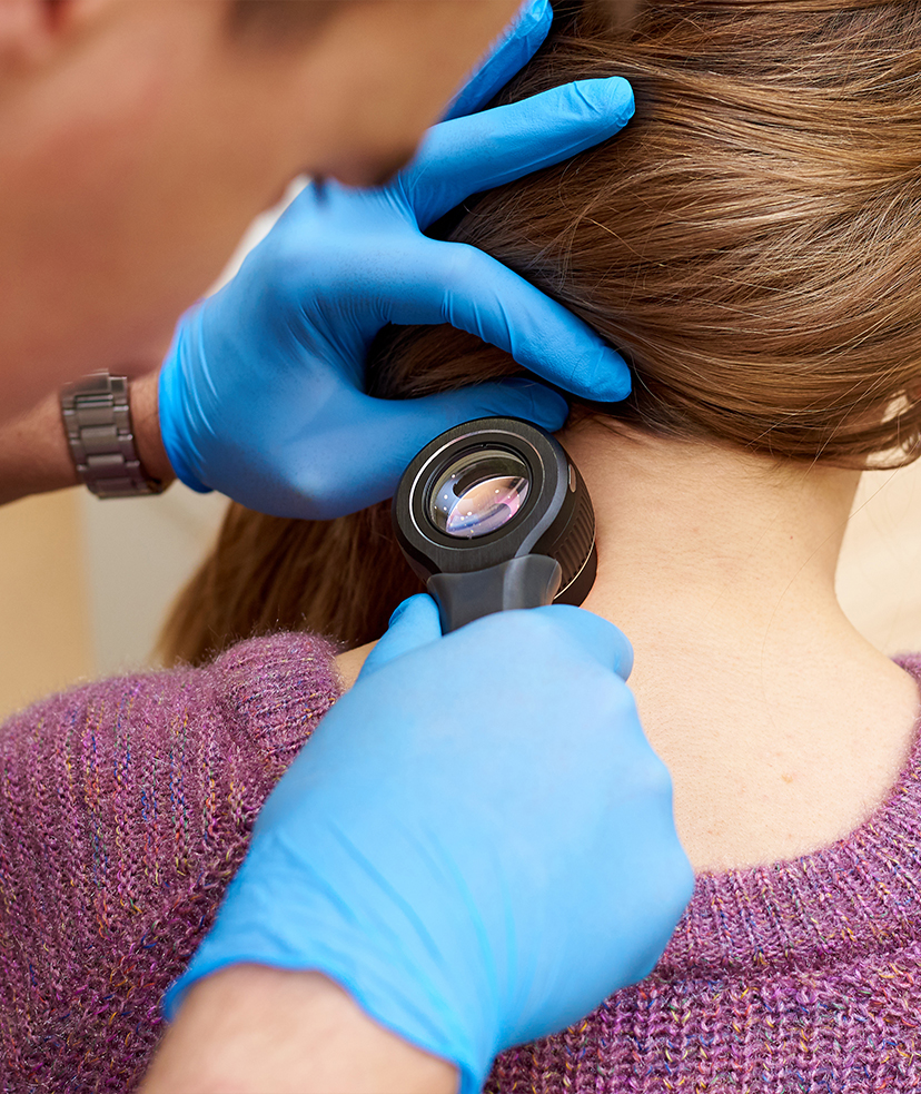 Photo of a doctor using a dermascope on a female patient