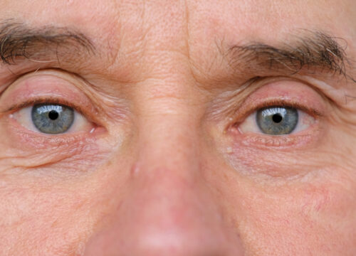 Photo of a man's face and blue eyes