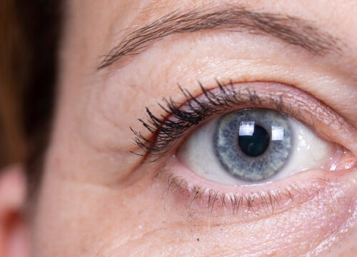 Photo of a woman's blue eye
