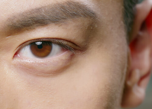 Photo of a man's brown eye