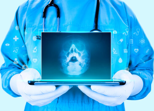 Photo of a surgeon holding up a laptop with the x-ray of a skull
